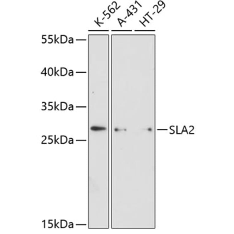 Western Blot - Anti-SLAP2 Antibody (A89052) - Antibodies.com
