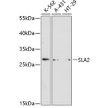 Western Blot - Anti-SLAP2 Antibody (A89052) - Antibodies.com