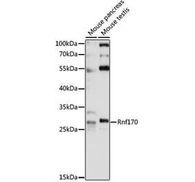 Western Blot - Anti-RNF170 Antibody (A89053) - Antibodies.com