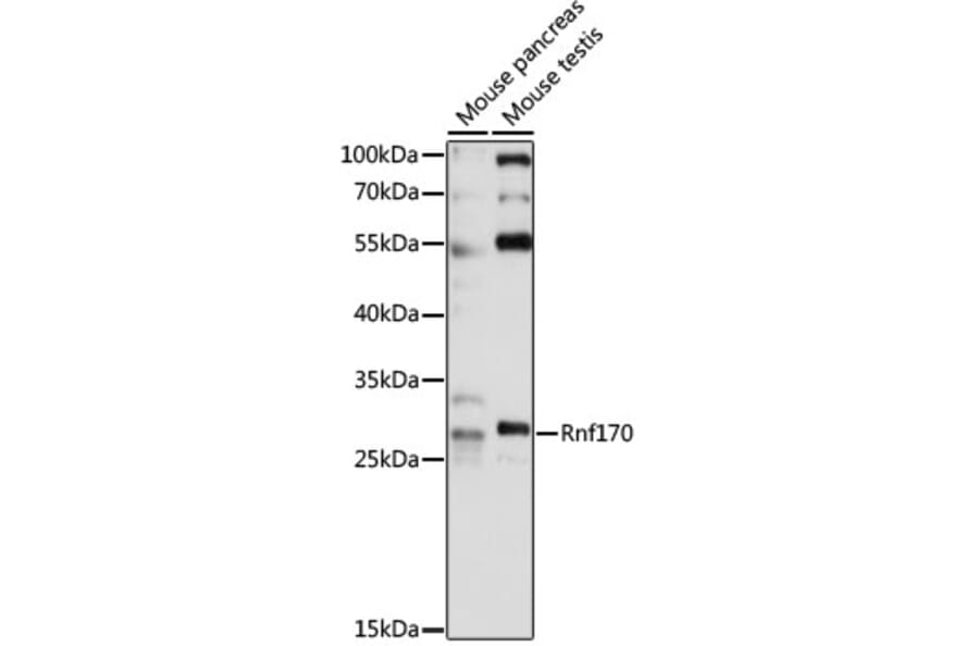 Western Blot - Anti-RNF170 Antibody (A89053) - Antibodies.com