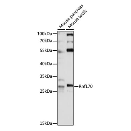 Western Blot - Anti-RNF170 Antibody (A89053) - Antibodies.com