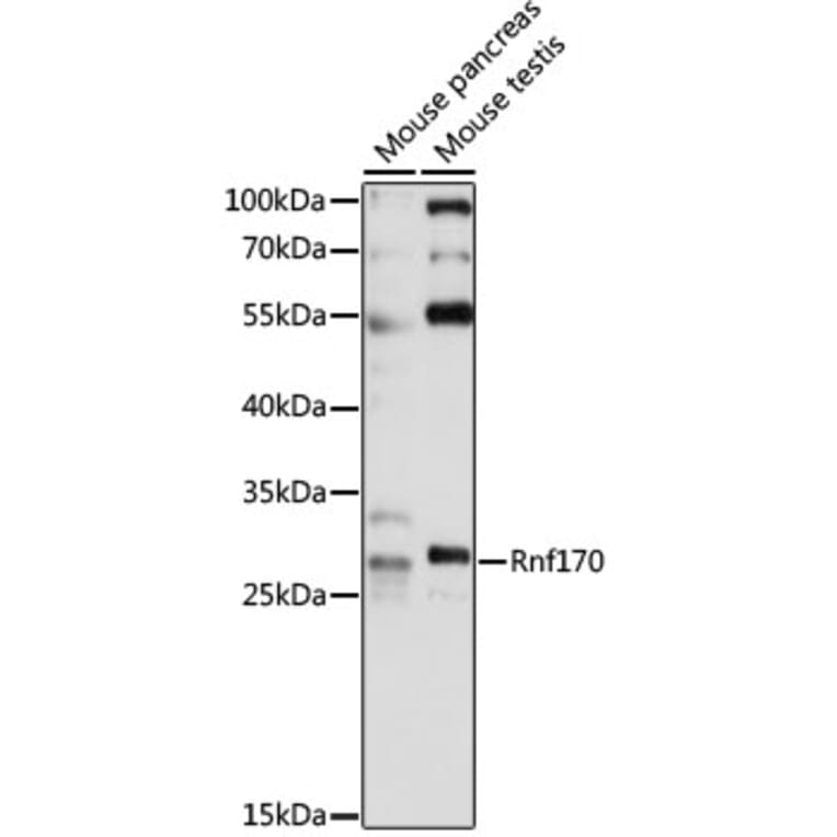 Western Blot - Anti-RNF170 Antibody (A89053) - Antibodies.com
