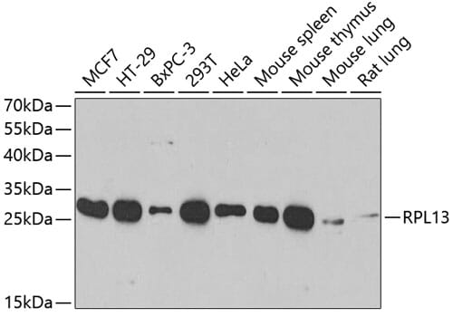 Western blot analysis of extracts of various cell lines, using Anti-RPL13 Antibody (A4083) at 1:1,000 dilution.
Secondary antibody: Goat Anti-Rabbit IgG (H+L) (HRP) (AS014) at 1:10,000 dilution.
Lysates / proteins: 25µg per lane.
Blocking buffer: 3% non-fat dry milk in TBST.
Detection: ECL Basic Kit (RM00020).
Exposure time: 15s.