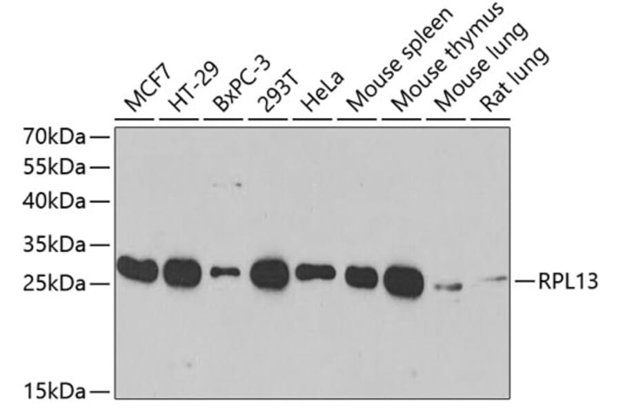 Western Blot - Anti-RPL13 Antibody (A89055) - Antibodies.com