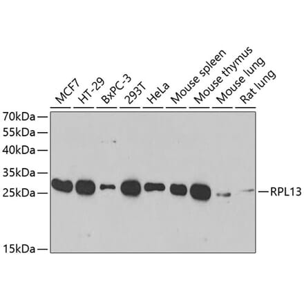 Western Blot - Anti-RPL13 Antibody (A89055) - Antibodies.com