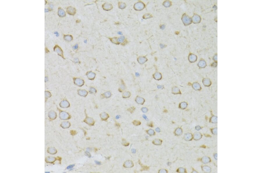 Immunohistochemistry - Anti-RPL13 Antibody (A89055) - Antibodies.com