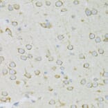 Immunohistochemistry - Anti-RPL13 Antibody (A89055) - Antibodies.com