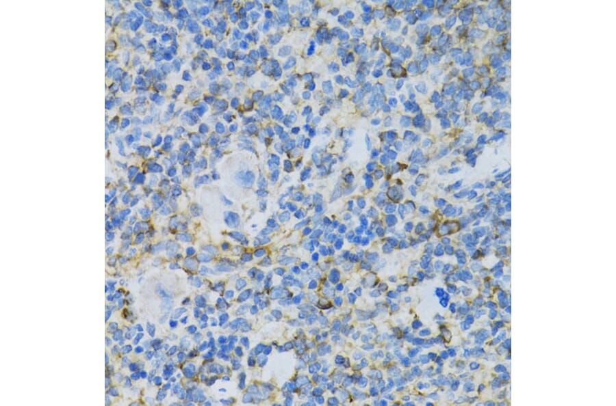 Immunohistochemistry - Anti-RPL13 Antibody (A89055) - Antibodies.com