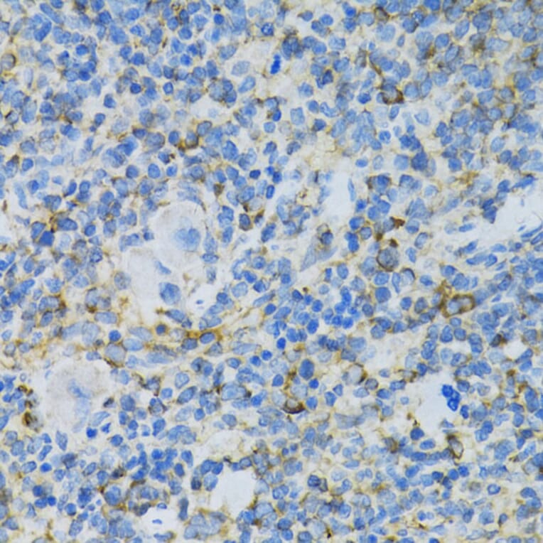 Immunohistochemistry - Anti-RPL13 Antibody (A89055) - Antibodies.com