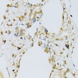 Immunohistochemistry - Anti-RPL13 Antibody (A89055) - Antibodies.com