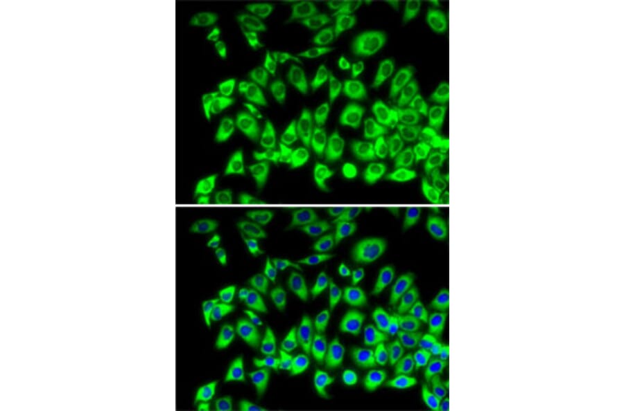 Immunofluorescence - Anti-RPL13 Antibody (A89055) - Antibodies.com