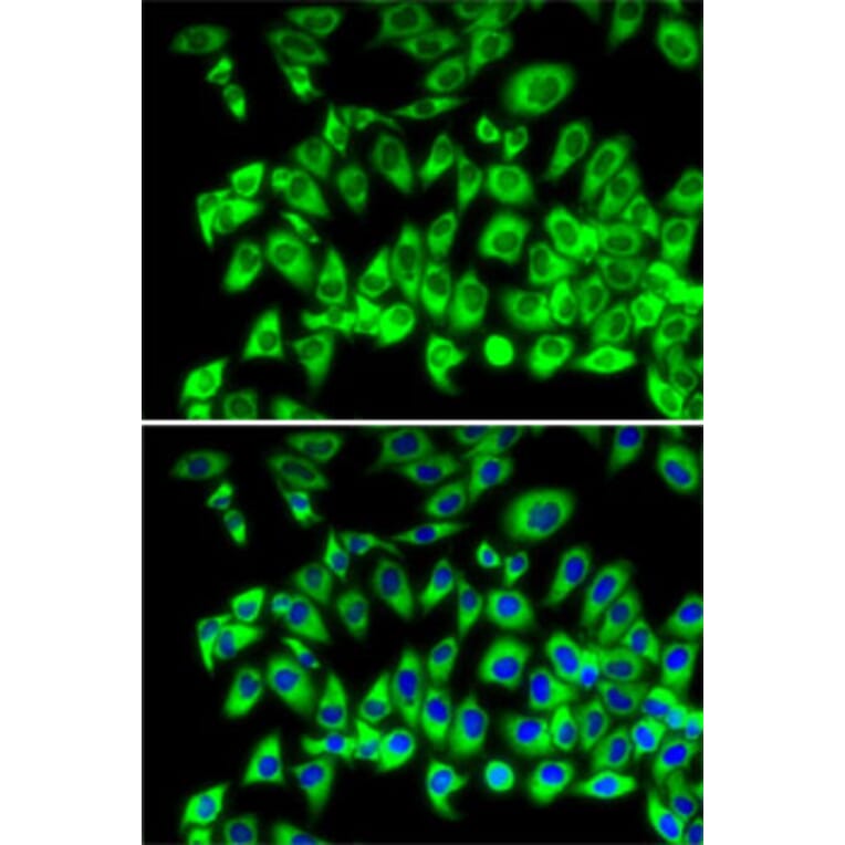 Immunofluorescence - Anti-RPL13 Antibody (A89055) - Antibodies.com
