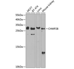 Western Blot - Anti-CHMP2B Antibody (A89056) - Antibodies.com