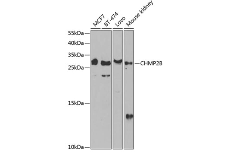 Western Blot - Anti-CHMP2B Antibody (A89056) - Antibodies.com