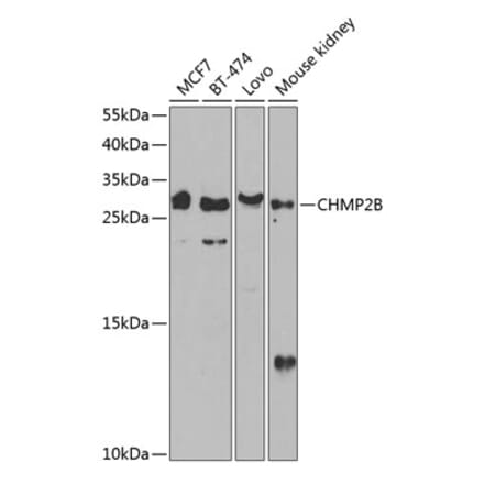 Western Blot - Anti-CHMP2B Antibody (A89056) - Antibodies.com