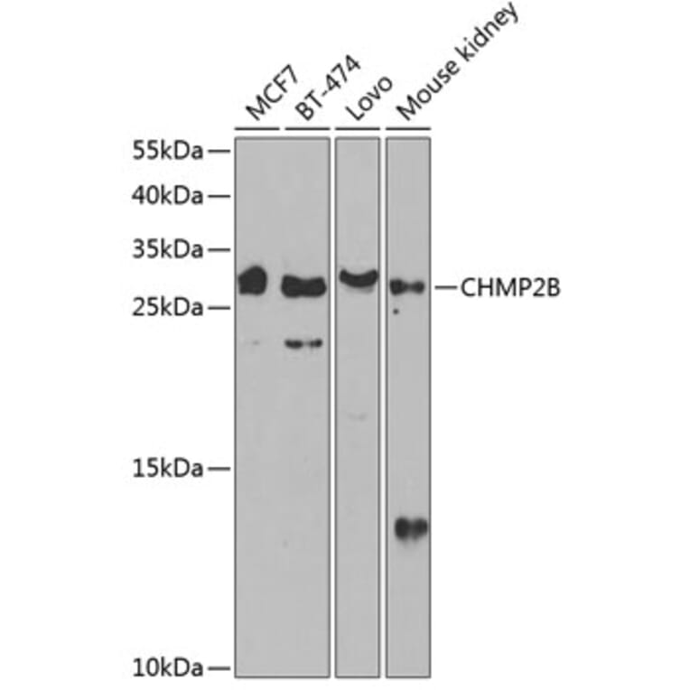 Western Blot - Anti-CHMP2B Antibody (A89056) - Antibodies.com