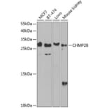 Western Blot - Anti-CHMP2B Antibody (A89056) - Antibodies.com