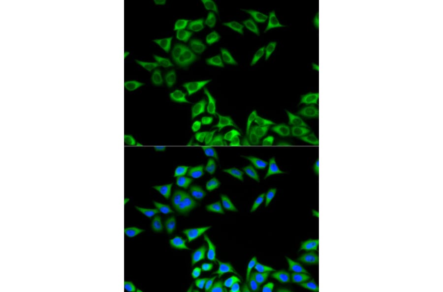 Immunofluorescence - Anti-CHMP2B Antibody (A89056) - Antibodies.com