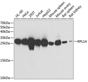 Western Blot - Anti-RPL14 Antibody (A89057) - Antibodies.com