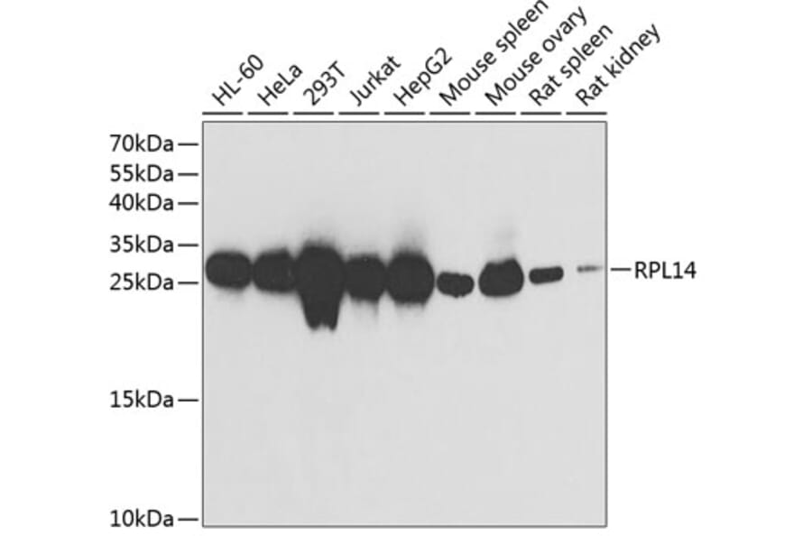 Western Blot - Anti-RPL14 Antibody (A89057) - Antibodies.com
