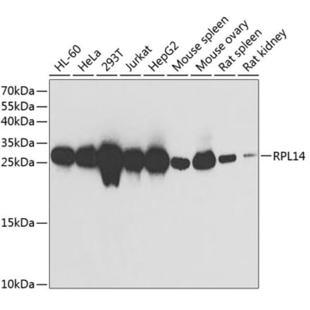 Western Blot - Anti-RPL14 Antibody (A89057) - Antibodies.com