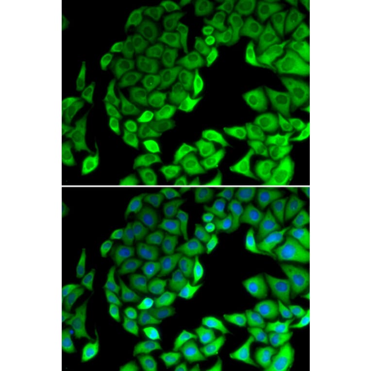 Immunofluorescence - Anti-RPL14 Antibody (A89057) - Antibodies.com
