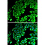 Immunofluorescence - Anti-RPL14 Antibody (A89057) - Antibodies.com