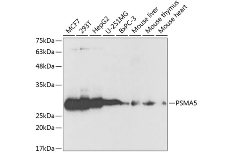 Western Blot - Anti-Proteasome 20S alpha 5/PSMA5 Antibody (A89058) - Antibodies.com