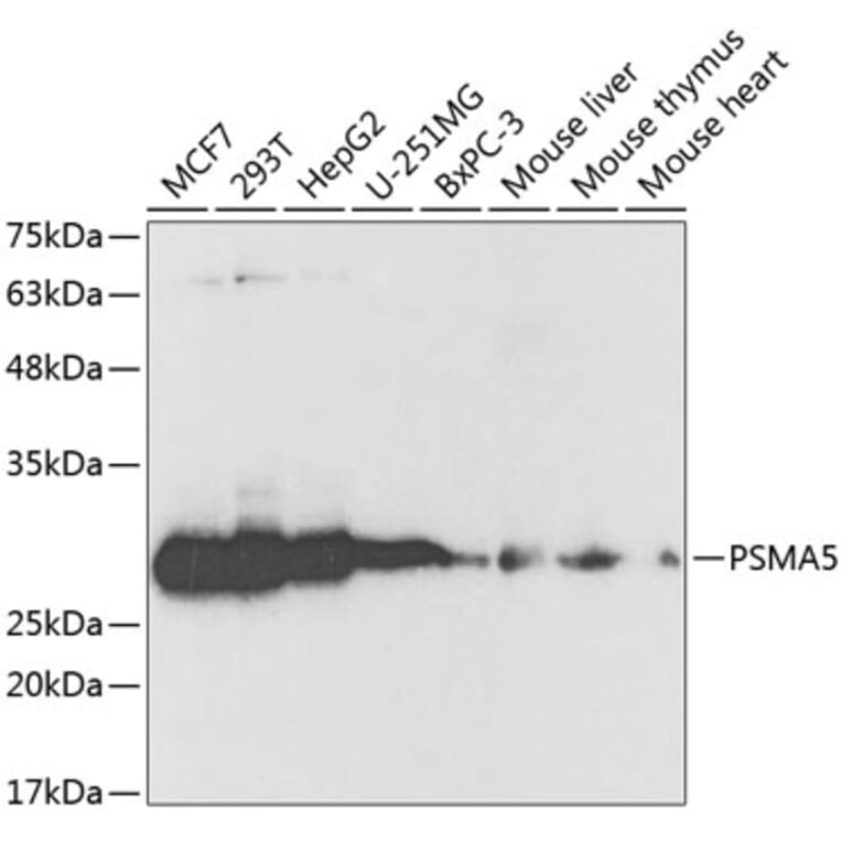 Western Blot - Anti-Proteasome 20S alpha 5/PSMA5 Antibody (A89058) - Antibodies.com