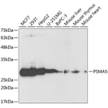 Western Blot - Anti-Proteasome 20S alpha 5/PSMA5 Antibody (A89058) - Antibodies.com