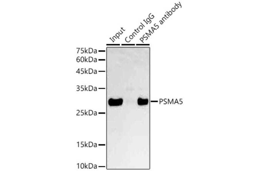 Western Blot - Anti-Proteasome 20S alpha 5/PSMA5 Antibody (A89058) - Antibodies.com