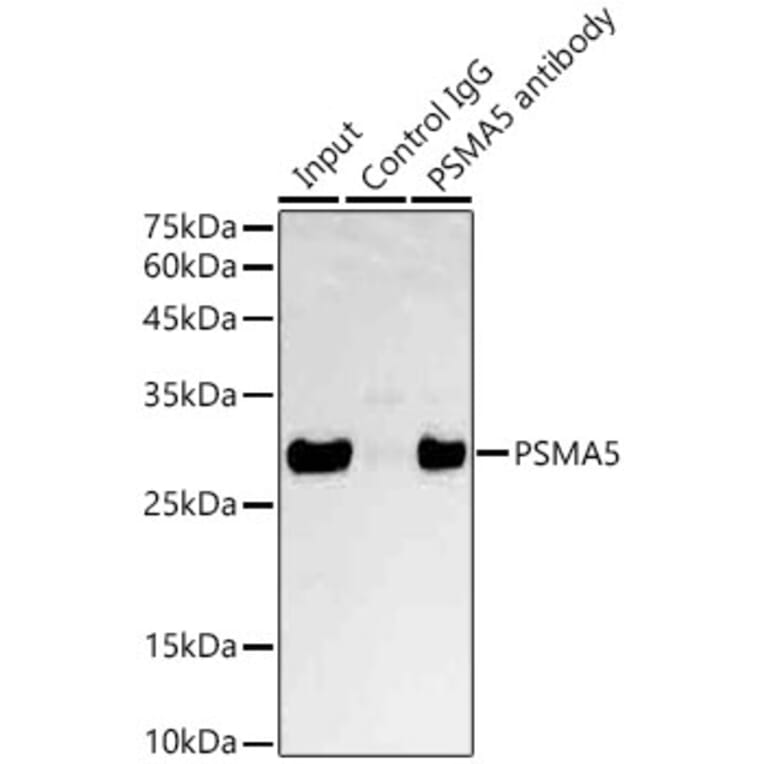 Western Blot - Anti-Proteasome 20S alpha 5/PSMA5 Antibody (A89058) - Antibodies.com