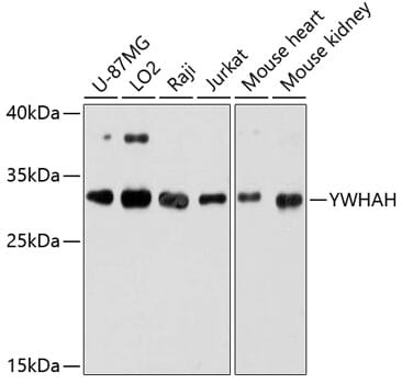 Western blot analysis of extracts of various cell lines, using Anti-YWHAH Antibody (A9079) at 1:3000 dilution.
Secondary antibody: Goat Anti-Rabbit IgG (H+L) (HRP) (AS014) at 1:10,000 dilution.
Lysates / proteins: 25µg per lane.
Blocking buffer: 3% non-fat dry milk in TBST.
Detection: ECL Basic Kit (RM00020).
Exposure time: 60s.