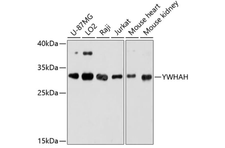 Western Blot - Anti-14-3-3 eta/YWHAH Antibody (A89060) - Antibodies.com