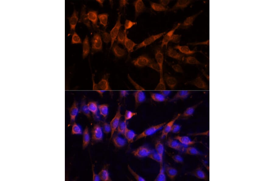 Immunofluorescence - Anti-14-3-3 eta/YWHAH Antibody (A89060) - Antibodies.com