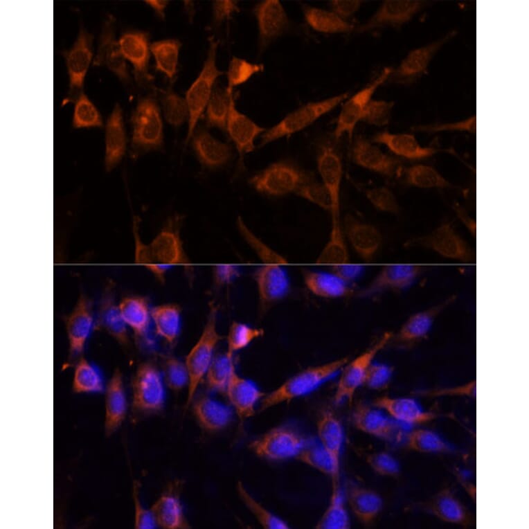 Immunofluorescence - Anti-14-3-3 eta/YWHAH Antibody (A89060) - Antibodies.com