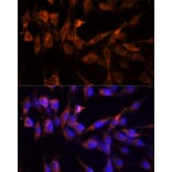 Immunofluorescence - Anti-14-3-3 eta/YWHAH Antibody (A89060) - Antibodies.com