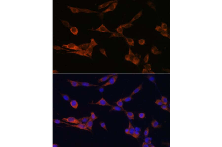 Immunofluorescence - Anti-14-3-3 eta/YWHAH Antibody (A89060) - Antibodies.com