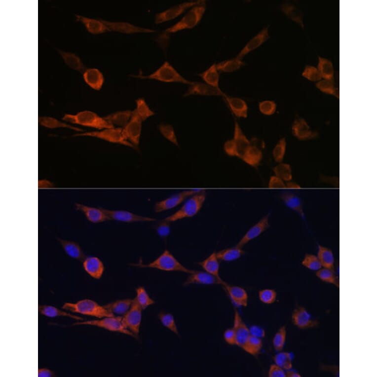 Immunofluorescence - Anti-14-3-3 eta/YWHAH Antibody (A89060) - Antibodies.com