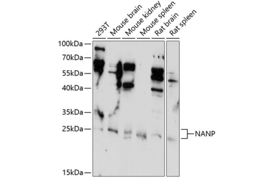 Western Blot - Anti-NANP Antibody (A89061) - Antibodies.com
