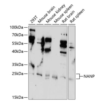 Western Blot - Anti-NANP Antibody (A89061) - Antibodies.com