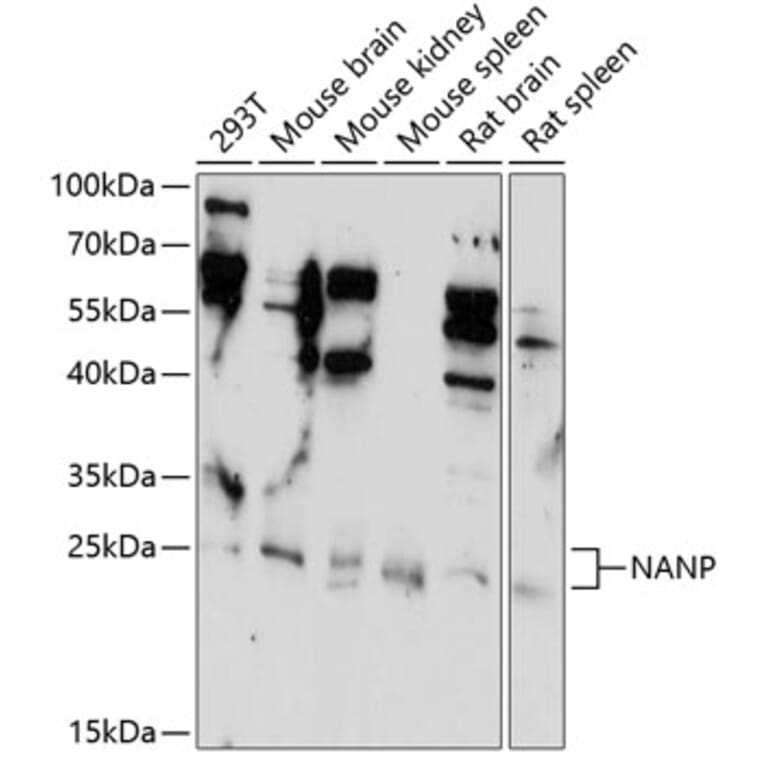 Western Blot - Anti-NANP Antibody (A89061) - Antibodies.com