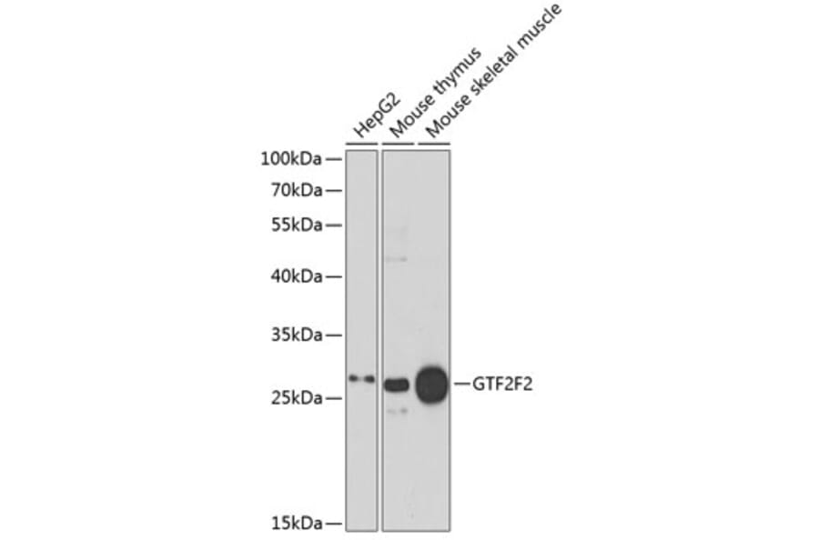 Western Blot - Anti-GTF2F2 Antibody (A89062) - Antibodies.com
