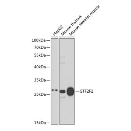 Western Blot - Anti-GTF2F2 Antibody (A89062) - Antibodies.com