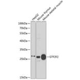 Western Blot - Anti-GTF2F2 Antibody (A89062) - Antibodies.com