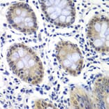 Immunohistochemistry - Anti-GTF2F2 Antibody (A89062) - Antibodies.com