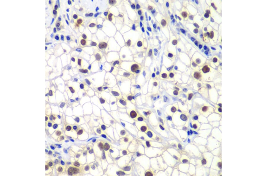 Immunohistochemistry - Anti-GTF2F2 Antibody (A89062) - Antibodies.com