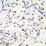 Immunohistochemistry - Anti-GTF2F2 Antibody (A89062) - Antibodies.com