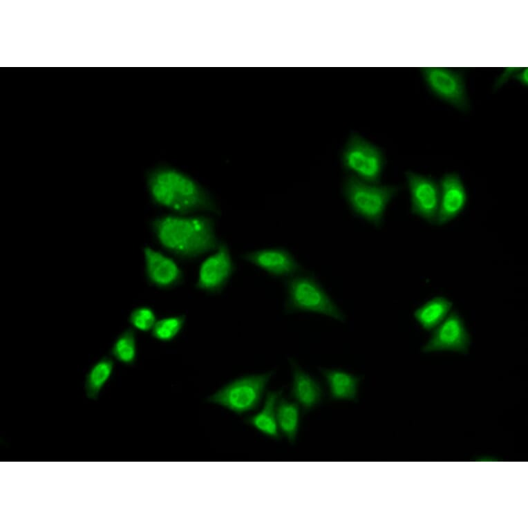 Immunofluorescence - Anti-GTF2F2 Antibody (A89062) - Antibodies.com