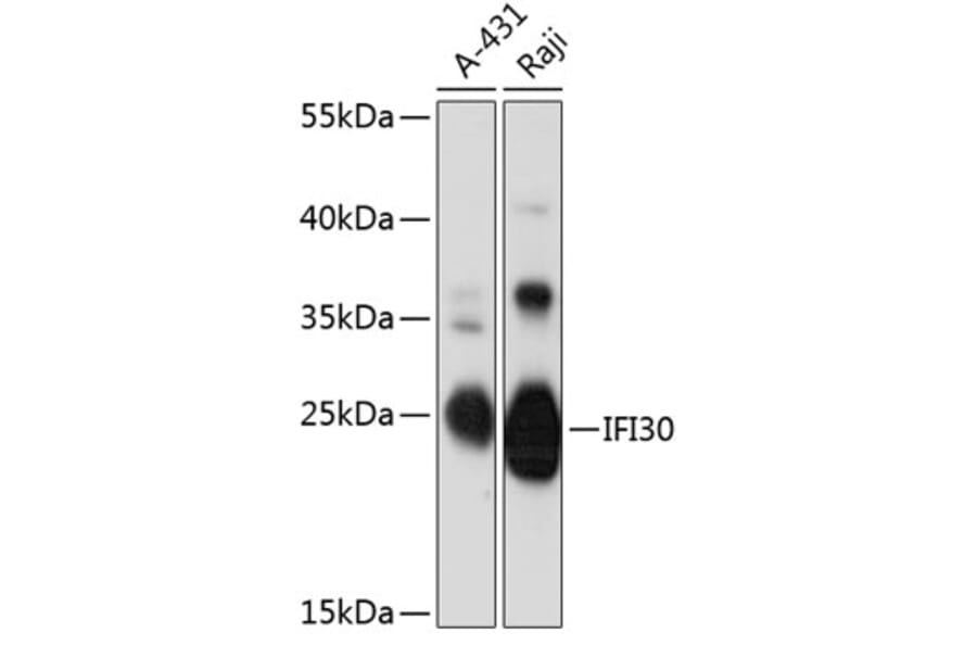Western Blot - Anti-GILT Antibody (A89063) - Antibodies.com